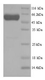 SDS-PAGE