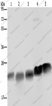 Вестерн-блоттинг, NDUFS8, клетки K562, HeLa, Jurkat и ткани сердца и селезенки мыши