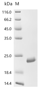 SDS-PAGE