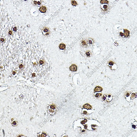 Иммуногистохимия, Histone H3, ткань мозга человека
