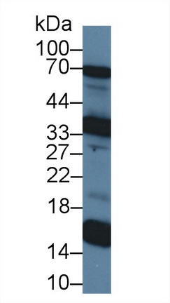 12689