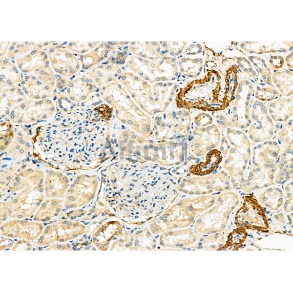 Валидация Affinity DF6914 - 18513