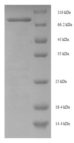 SDS-PAGE