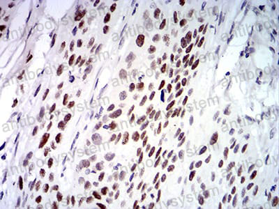 Валидация AntibodySystem RHK46902 (3676)