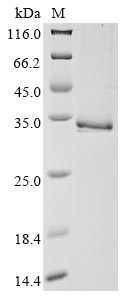 SDS-PAGE