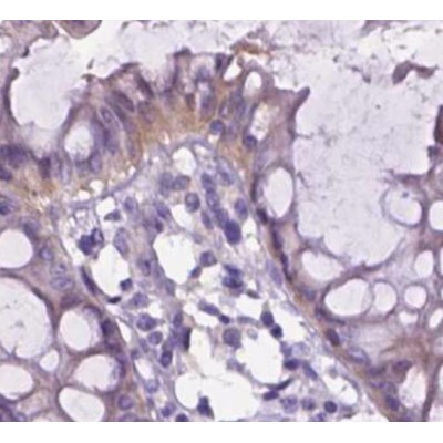 Валидация Affinity DF2544 - 13207