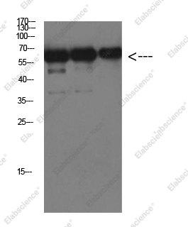 Вестерн-блоттинг, Luciferase, белок Luciferase
