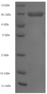 SDS-PAGE