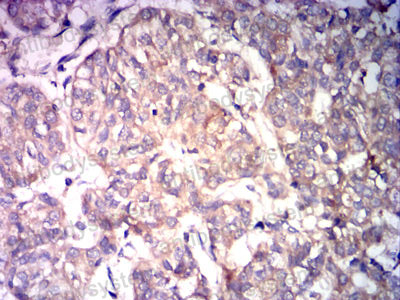 Валидация AntibodySystem RHD64405