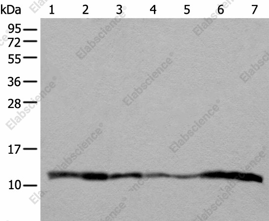 Вестерн-блоттинг, UQCRQ, клетки 293T, A549, HeLa, MDA-MB-231, HepG2 и ткани плаценты человека, печени плода человека