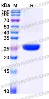 YHP08701, SDS-PAGE