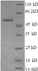 SDS-PAGE
