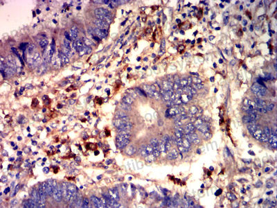 Валидация AntibodySystem RHD68905