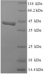 SDS-PAGE