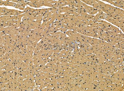 Валидация Affinity DF14189 - 10008