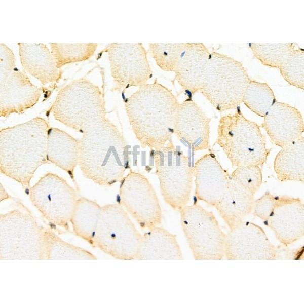 Валидация Affinity DF2963 - 13711