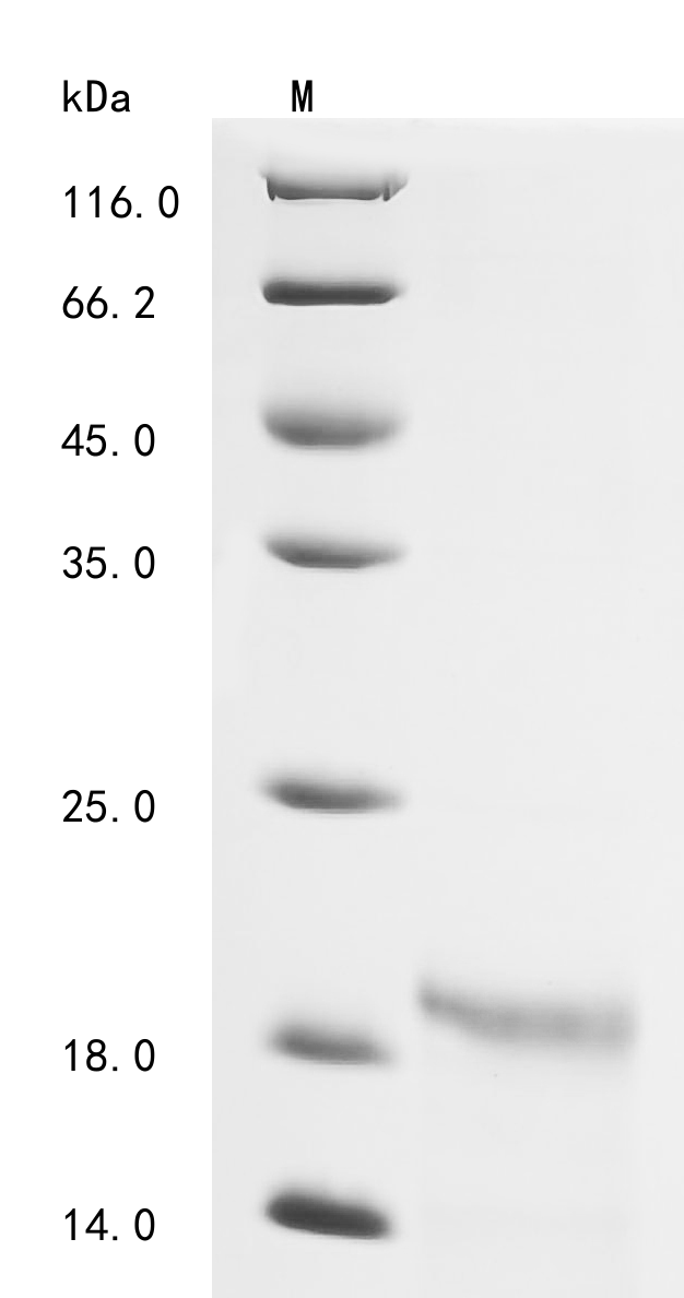 SDS-PAGE