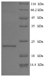 SDS-PAGE