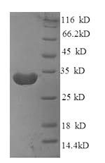 SDS-PAGE