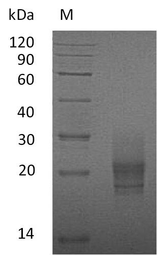 SDS-PAGE
