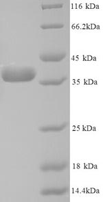 SDS-PAGE