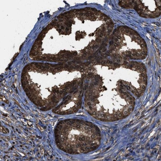 Валидация AssayVector ARM1387(1086)