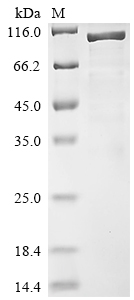 SDS-PAGE