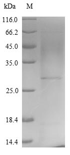 SDS-PAGE