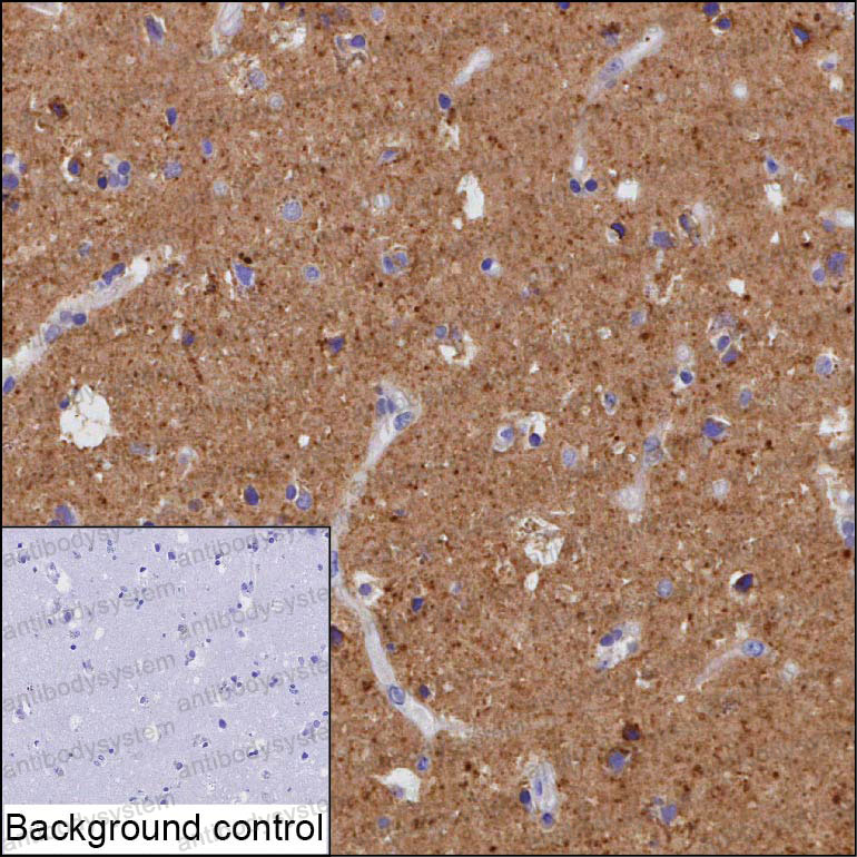 Валидация AntibodySystem RHP09401
