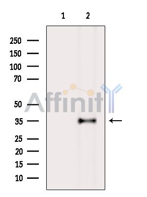 Валидация Affinity DF14032 - 9798