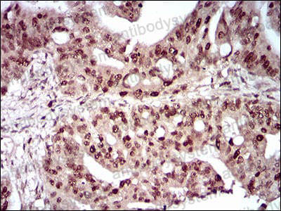Валидация AntibodySystem RHA62803