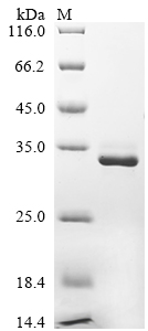 SDS-PAGE