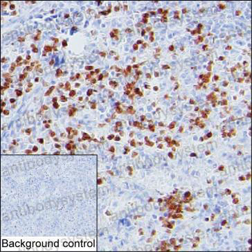 Валидация AntibodySystem RHF71601