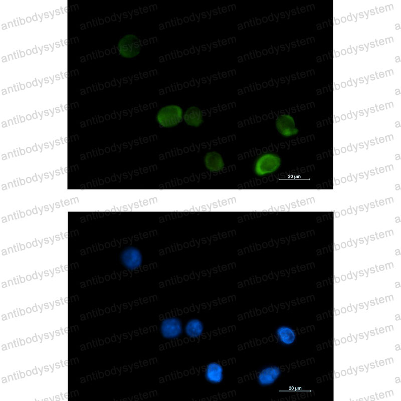 Валидация IF - AntibodySystem RHE38501