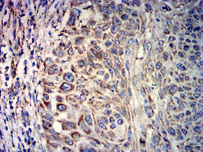 Валидация AntibodySystem RHD67603 (1708)