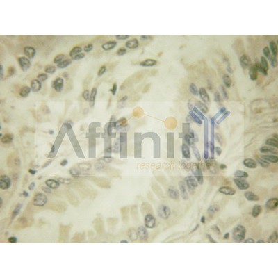 Валидация Affinity AF6442 - 3754