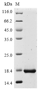 SDS-PAGE