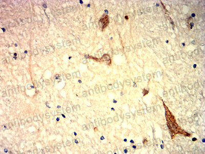 Валидация AntibodySystem RHG16102