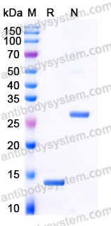 YHE39002, SDS-PAGE