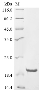 SDS-PAGE