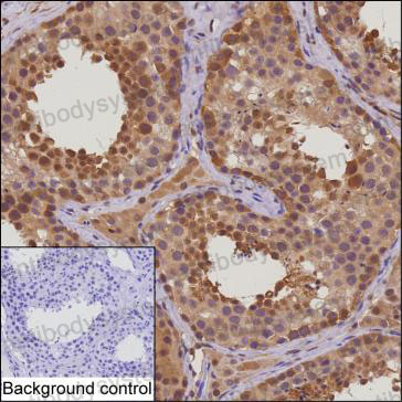 Валидация AntibodySystem RHC69304