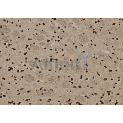 Валидация Affinity DF6279 - 17583