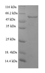 SDS-PAGE