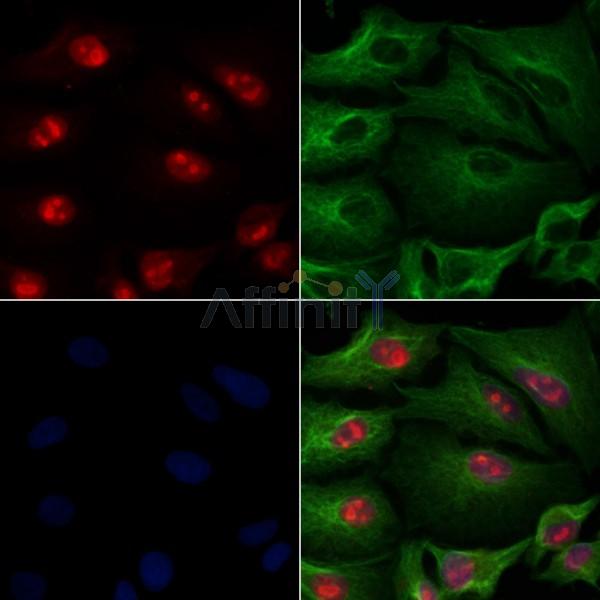 Валидация Affinity DF8408 - 20280