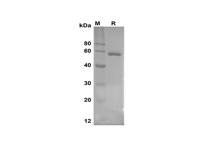 PDEH101149, электрофорез в ПААГ с ДСН