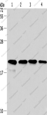 Вестерн-блоттинг, Cyclophilin F, клетки PC3, 293T, HeLa и ткань рака печени человека