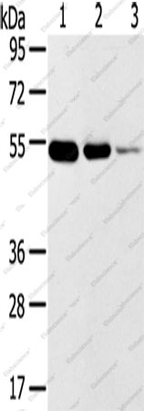 Вестерн-блоттинг, TMPRSS11F, ткань рака щитовидной железы и пищевода человека, нормальная ткань прямой кишки человека