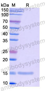 Валидация SDS-PAGE - AntibodySystem RHF68801