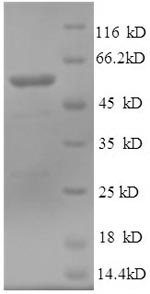 SDS-PAGE
