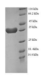 SDS-PAGE